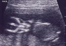 Face Ultrasound