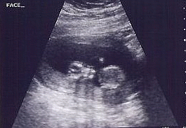 Face Ultrasound