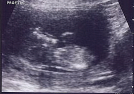 Profile Ultrasound