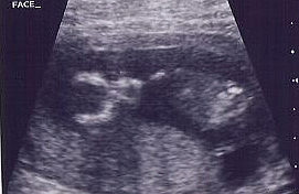 Face Ultrasound