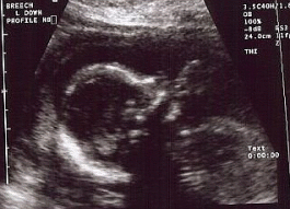 Profile Ultrasound