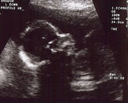 Profile Ultrasound